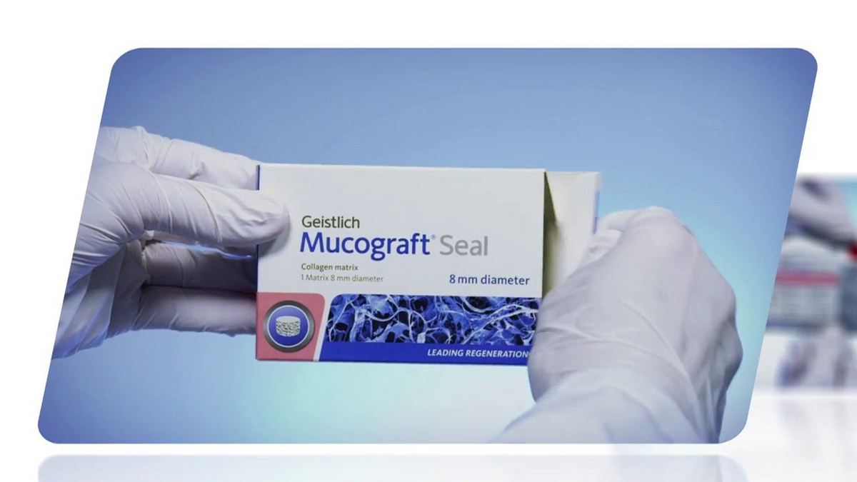 Handling video: Geistlich Mucograft® (PD Dr. Stefan Fickl, Wurzburg, Germany