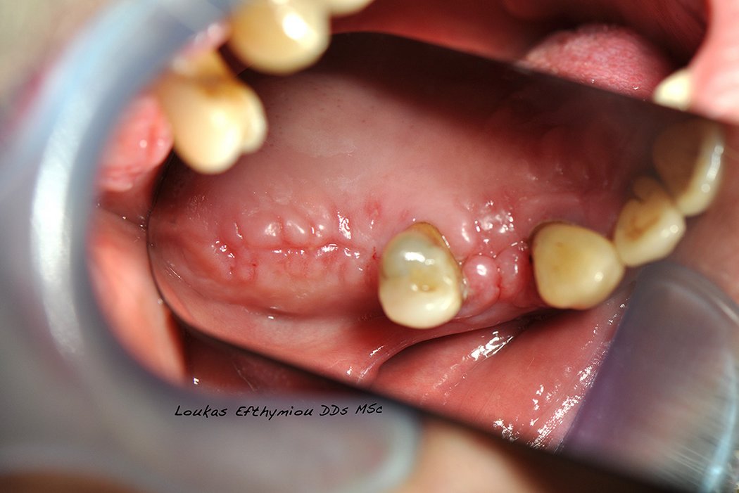 Figure 1: Situation at time of surgery